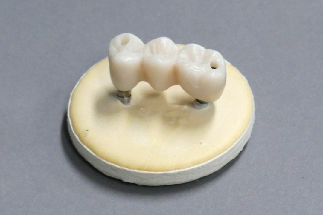 Dental Milling Machine Zirconia, Glass Ceramics, Custom Abutments