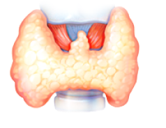 Как лечить узел щитовидной железы народными средствами в домашних условиях?