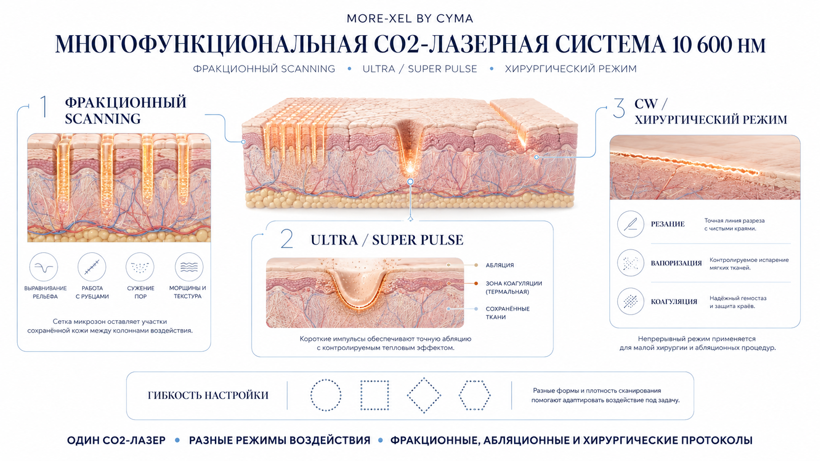 MORE-XEL CYMA: схема воздействия CO2 10 600 нм