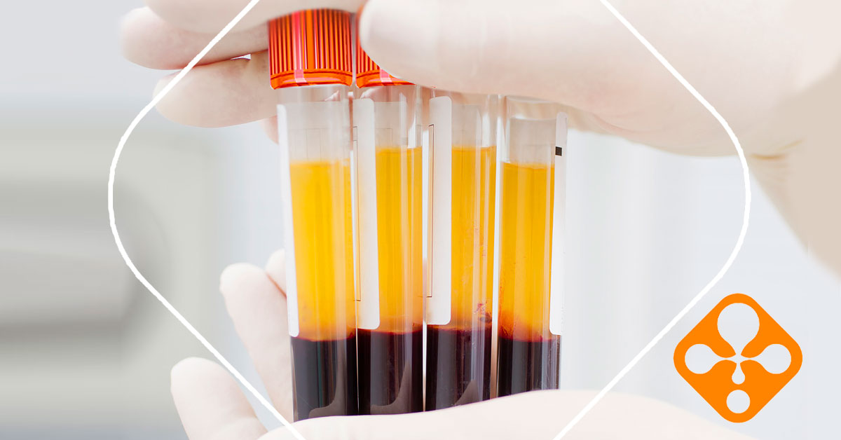 Пробирка prp kit 20 мл. Prp lab. Prp t lab. Пробирка prp kit 20 мл. Пробирки t lab для плазмотерапии.