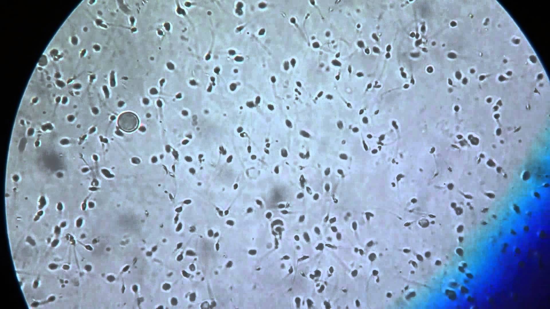 сперма при каком увеличении (120) фото