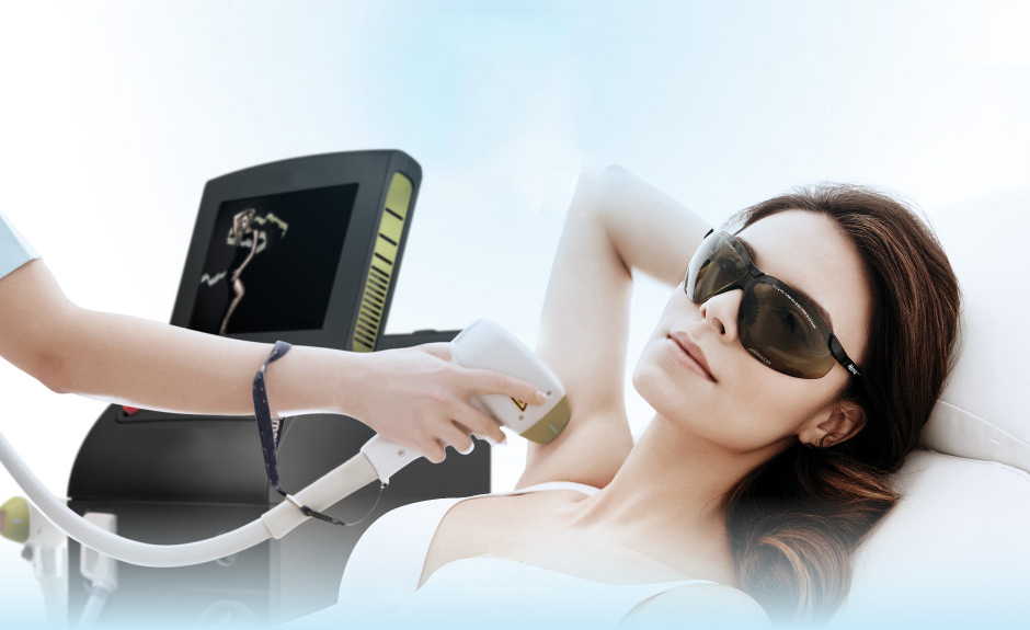 диодный лазер и александритовый в чем разница. волосы после фотоэпиляции. диодный лазер alma lasers. глубина воздействия лазера для эпиляции. эпиляция лица для женщин.