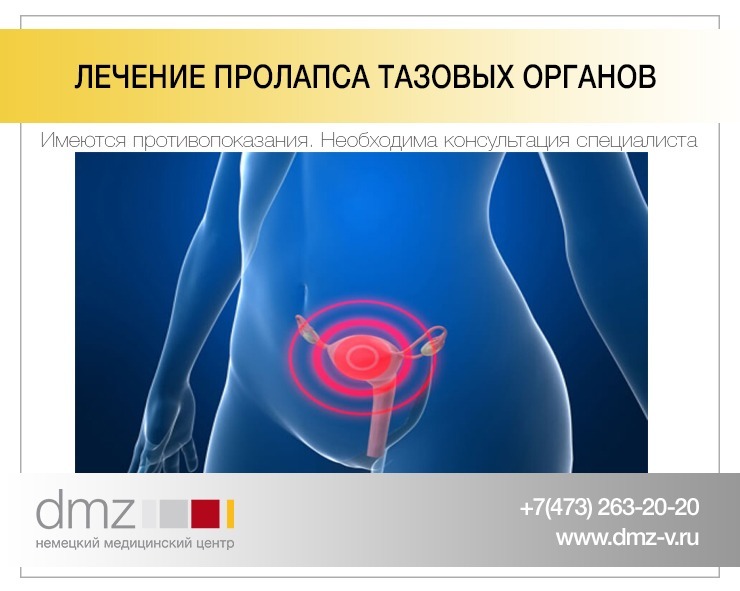 Пролапс тазовых органов презентация