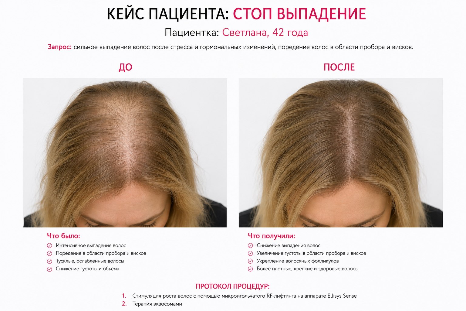 Кейс пациента до и после