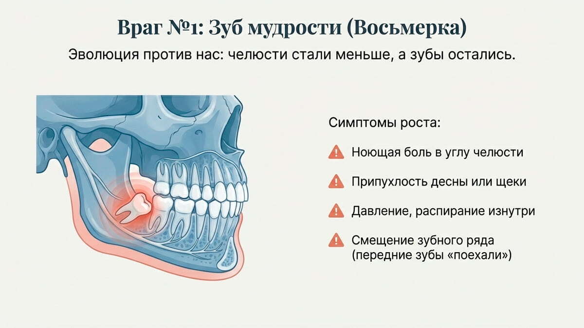 Как понять, что растёт зуб мудрости, и что делать