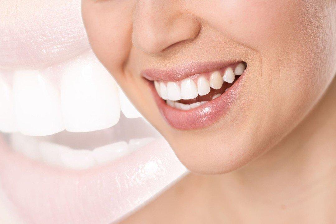 بهترین دکتر بلیچینگ در تهران: دکتر صالحیان