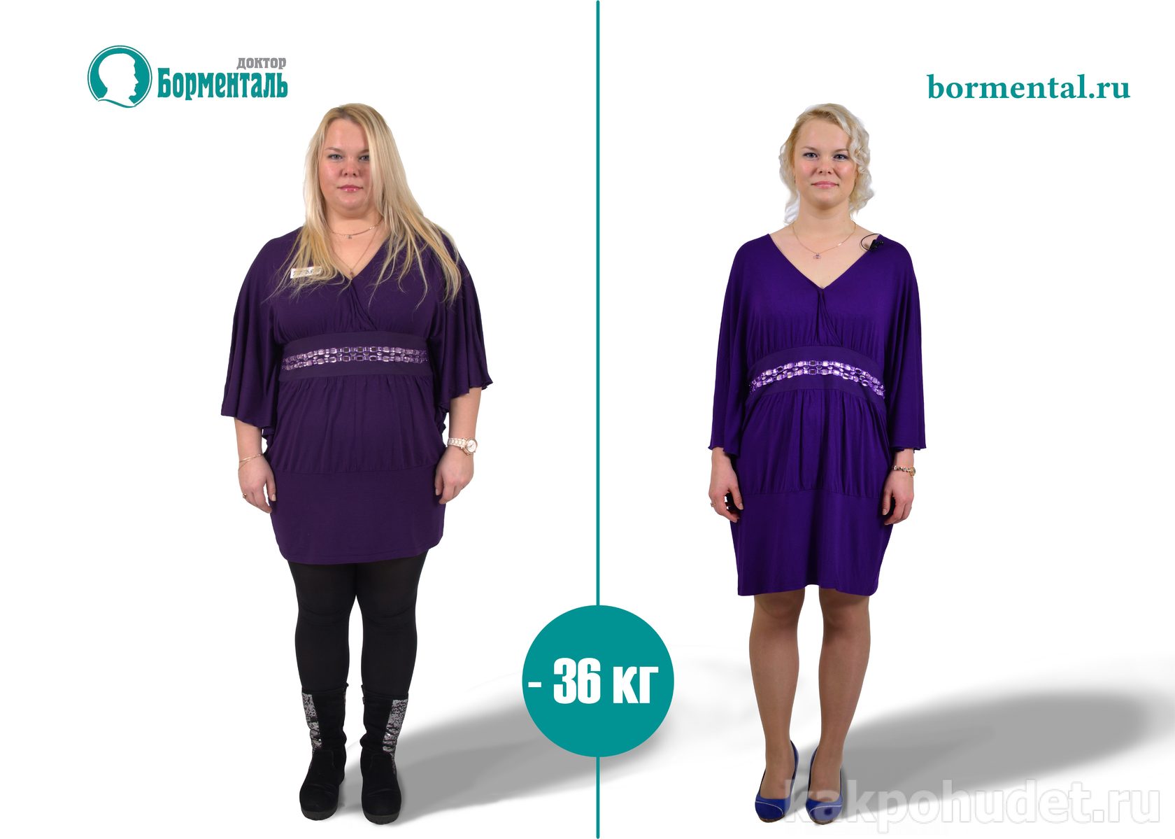 Диета борменталя отзывы форум в домашних условиях Диета борменталя отзывы форум в домашних условиях