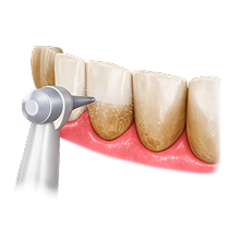 Чистка зубов