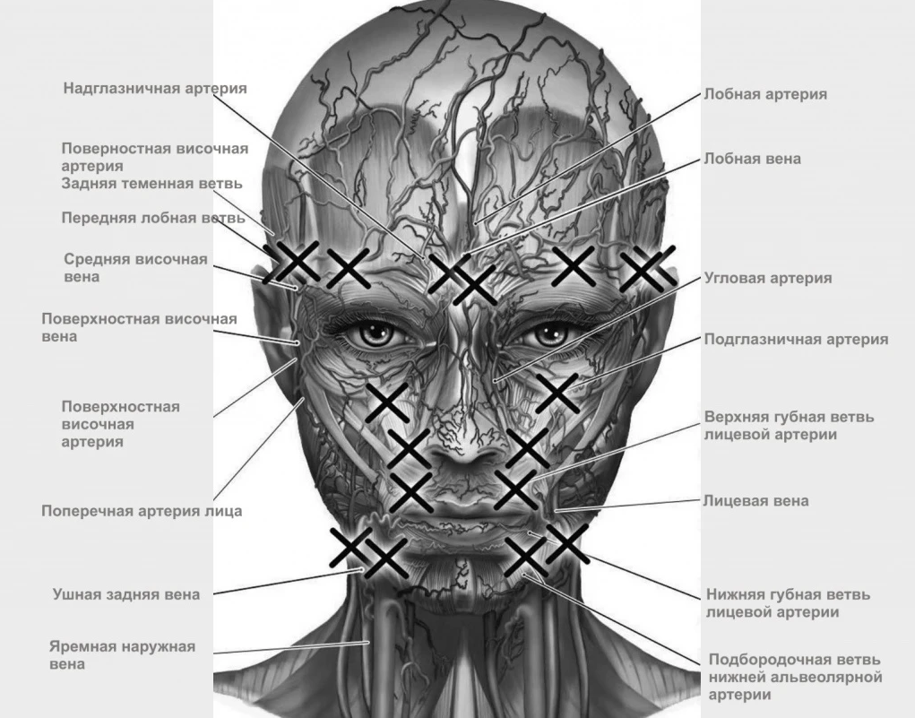 Точка после введения. Опасные зоны лица анатомия. Анатомия лица для косметологов опасные зоны. Сосуды лица анатомия для косметологов.