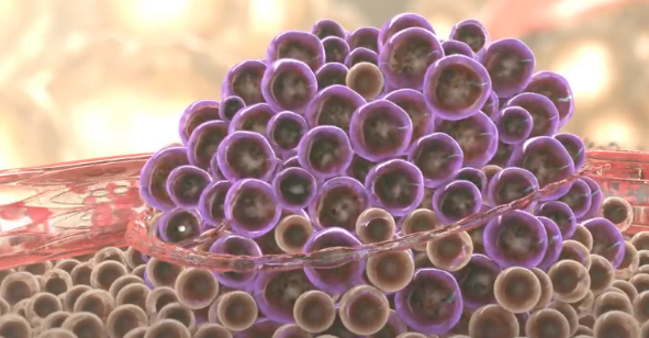 ионизатор воды лечение рака