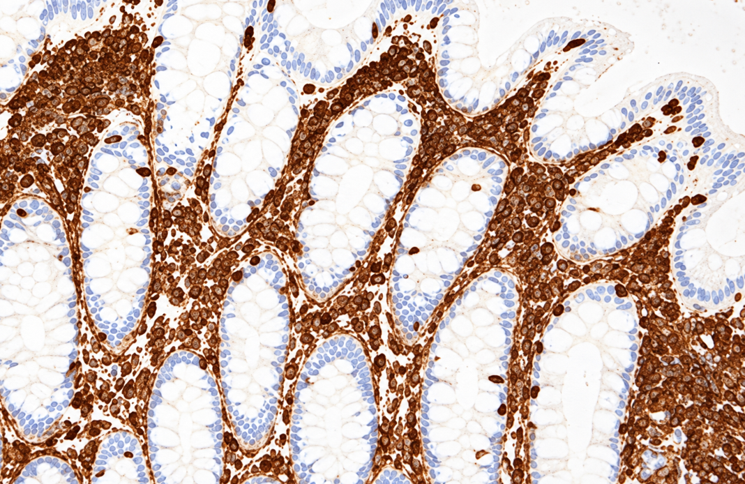 anti-Vimentin — иммуногистохимическое окрашивание ткани