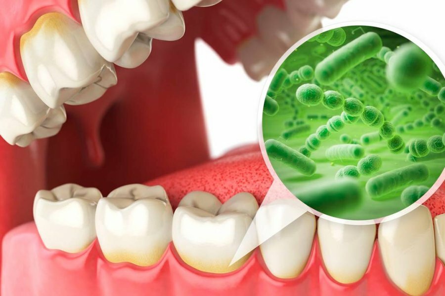 мифы о стоматологии