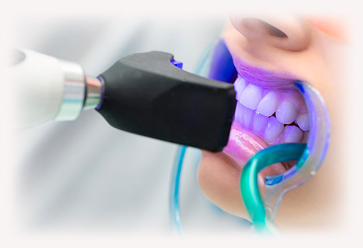 Как сделать зубы белее без вреда для здоровья