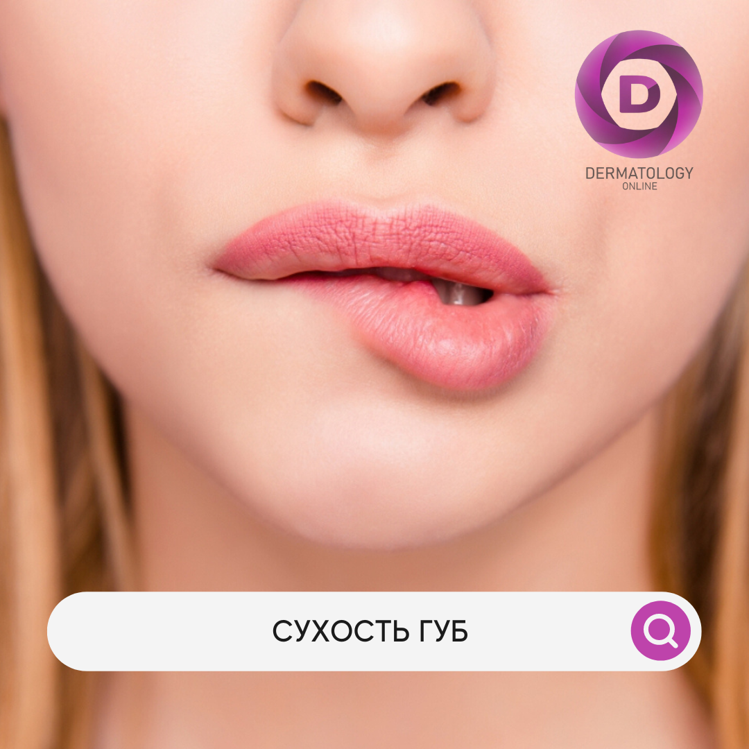 Сухость губ причины, лечение