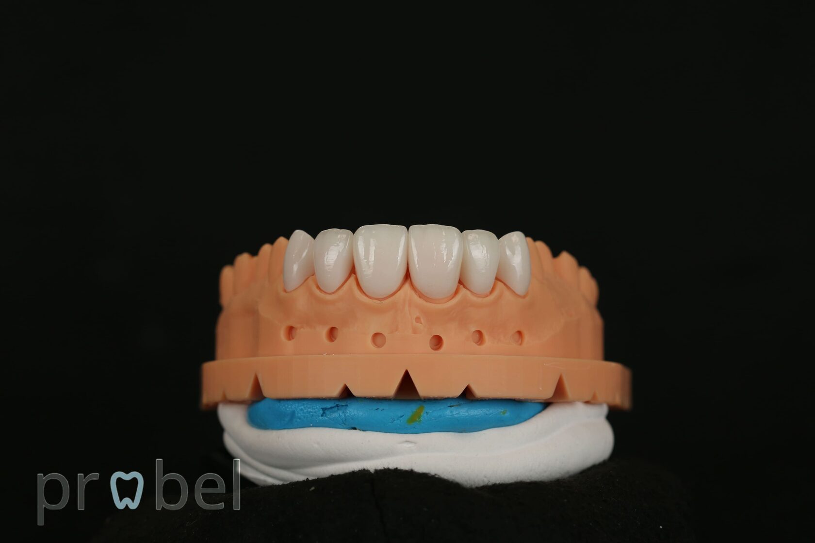 моделирование процесса установки керамических виниров