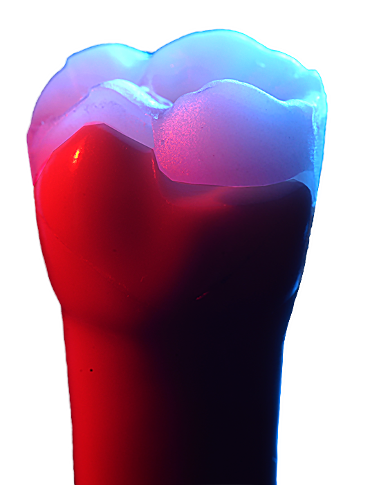 Bonding Zirconia crowns and Ceramic overlays. Stepbystep guide