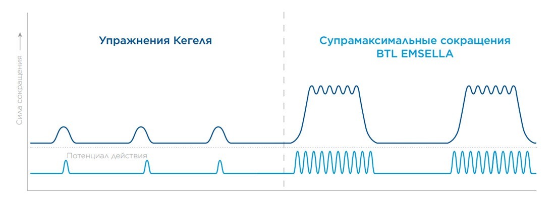 Стул для укрепления мышц тазового дна