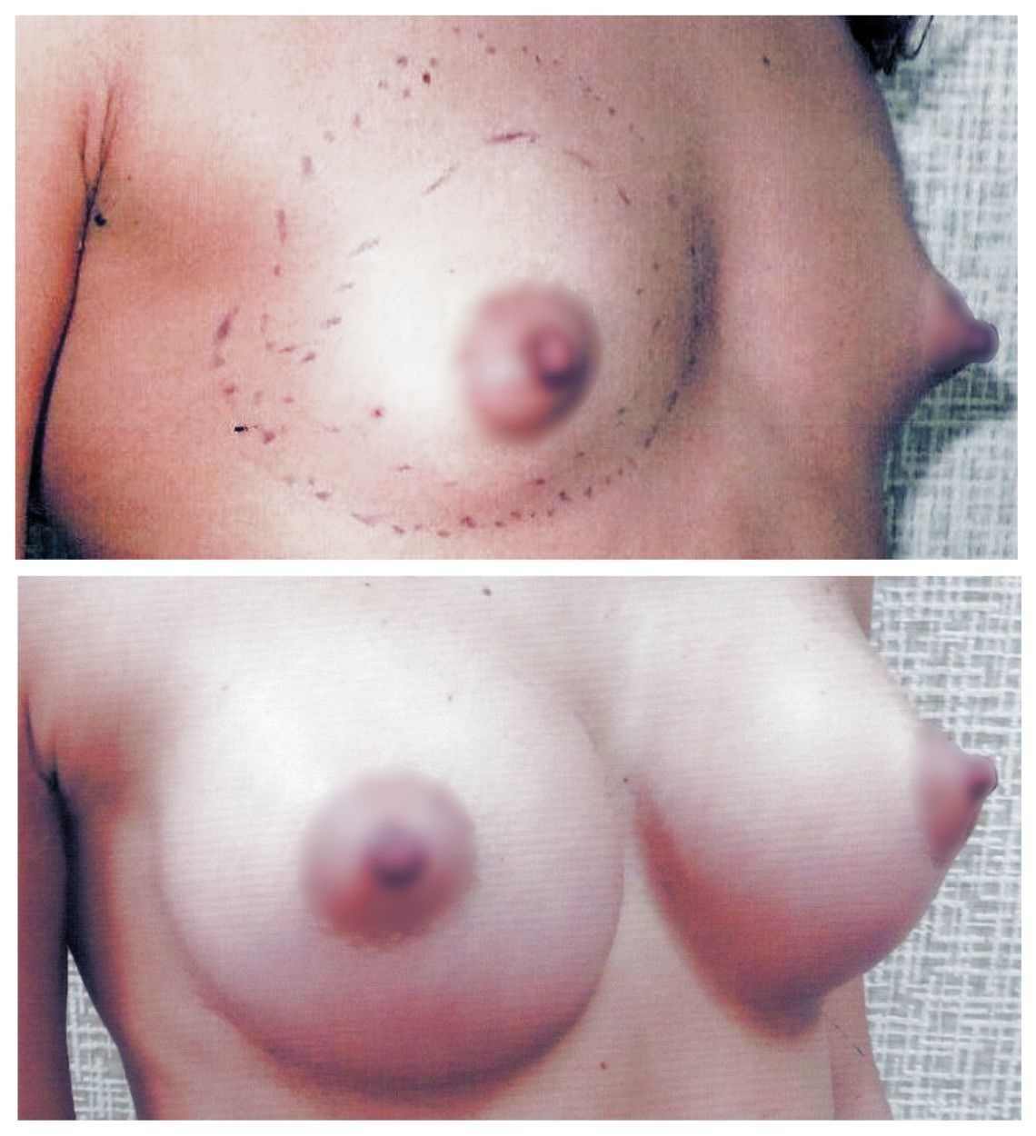 фото голая грудь после родов фото 79