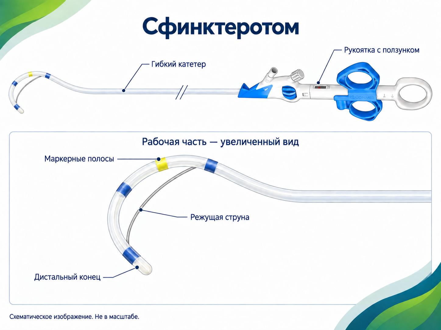 Сфинктеротомы