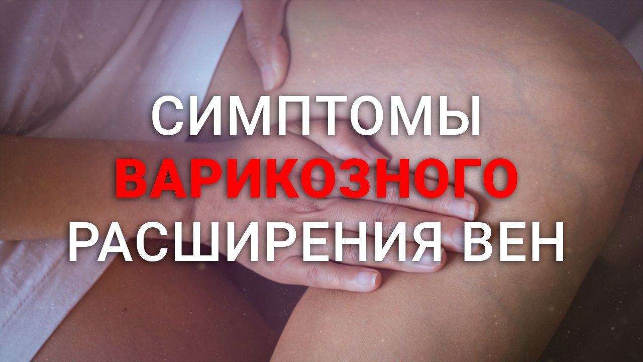 Симптомы варикозного расширения вен | Lauma Medical