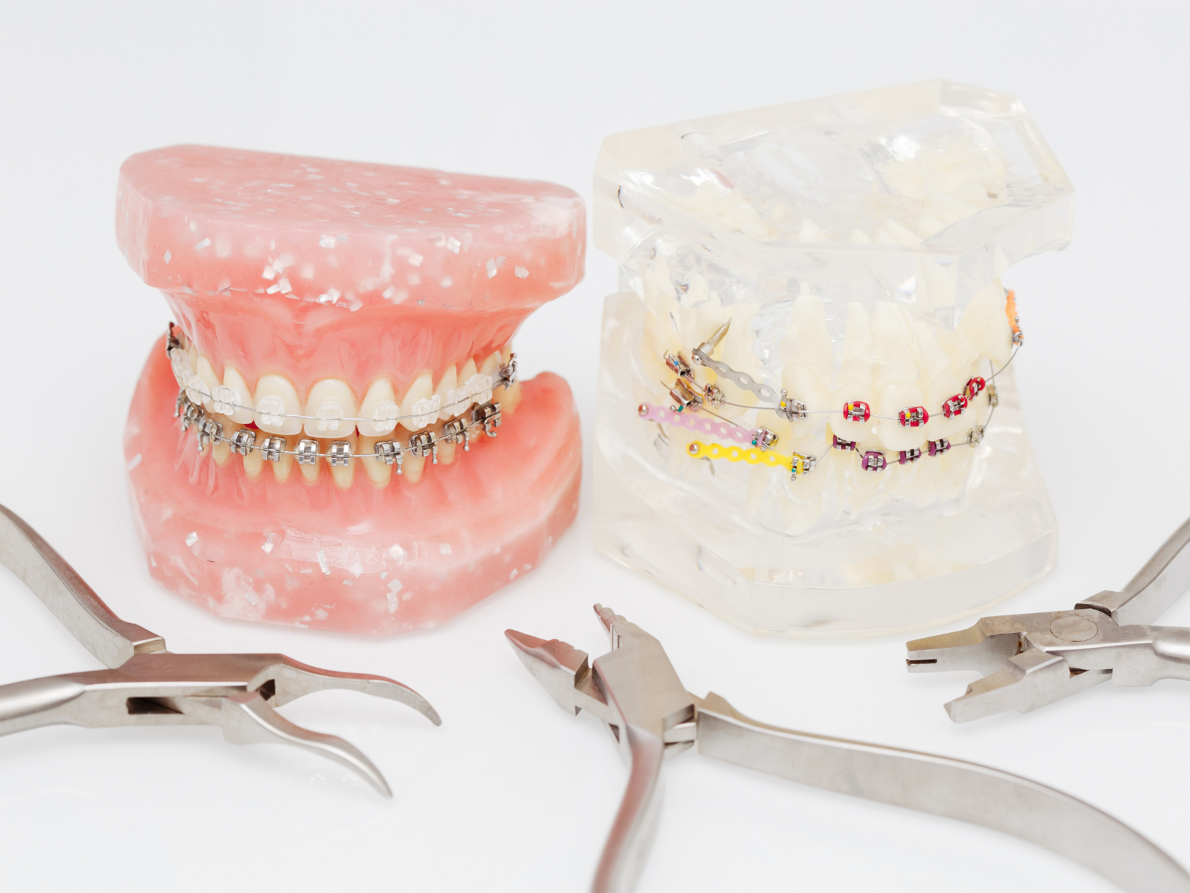 Учебные модели зубов с металлическими, керамическими и цветными брекетами, ортодонтические инструменты на фоне — визуализация вариантов брекет-систем.