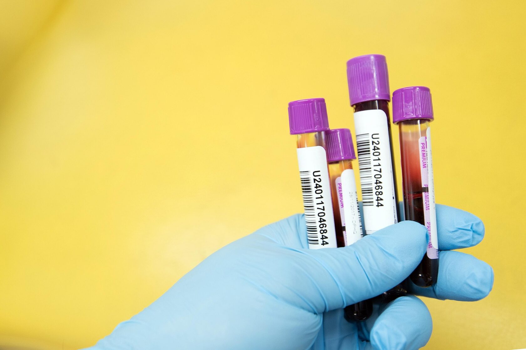 Blood test for longevity