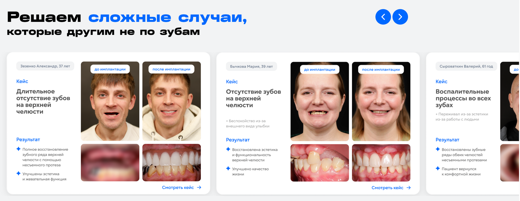 До имплантации