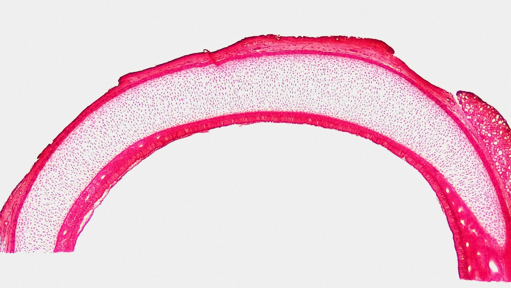 Superficie de implante dental con estructura láser, vista microscópica