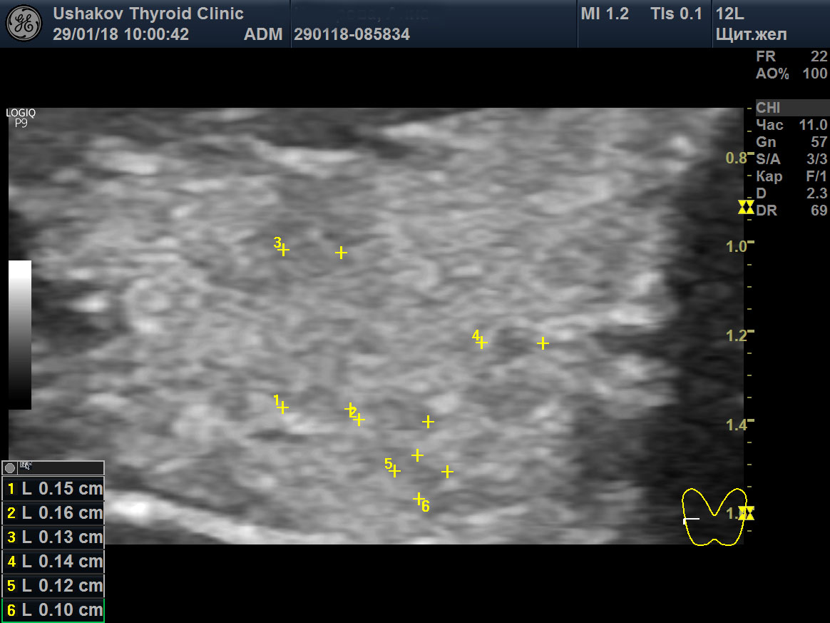 Узи почек изранов. Оборудование для эхокардиографии. Узи изранов протоколы. Задачи по узи. Узи сердца видеоурок изранов.