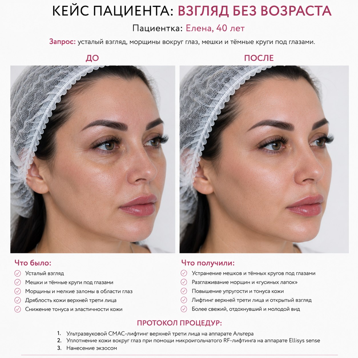 Кейс пациента до и после