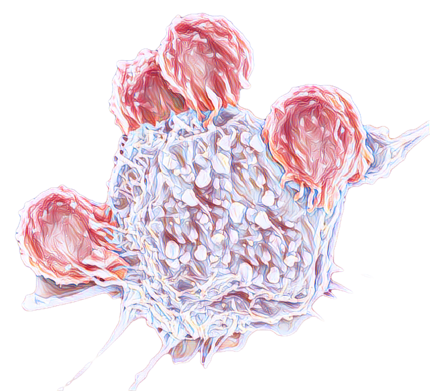 Рак яичников терапия. Цитокиногенетическая терапия онкологии что это такое.