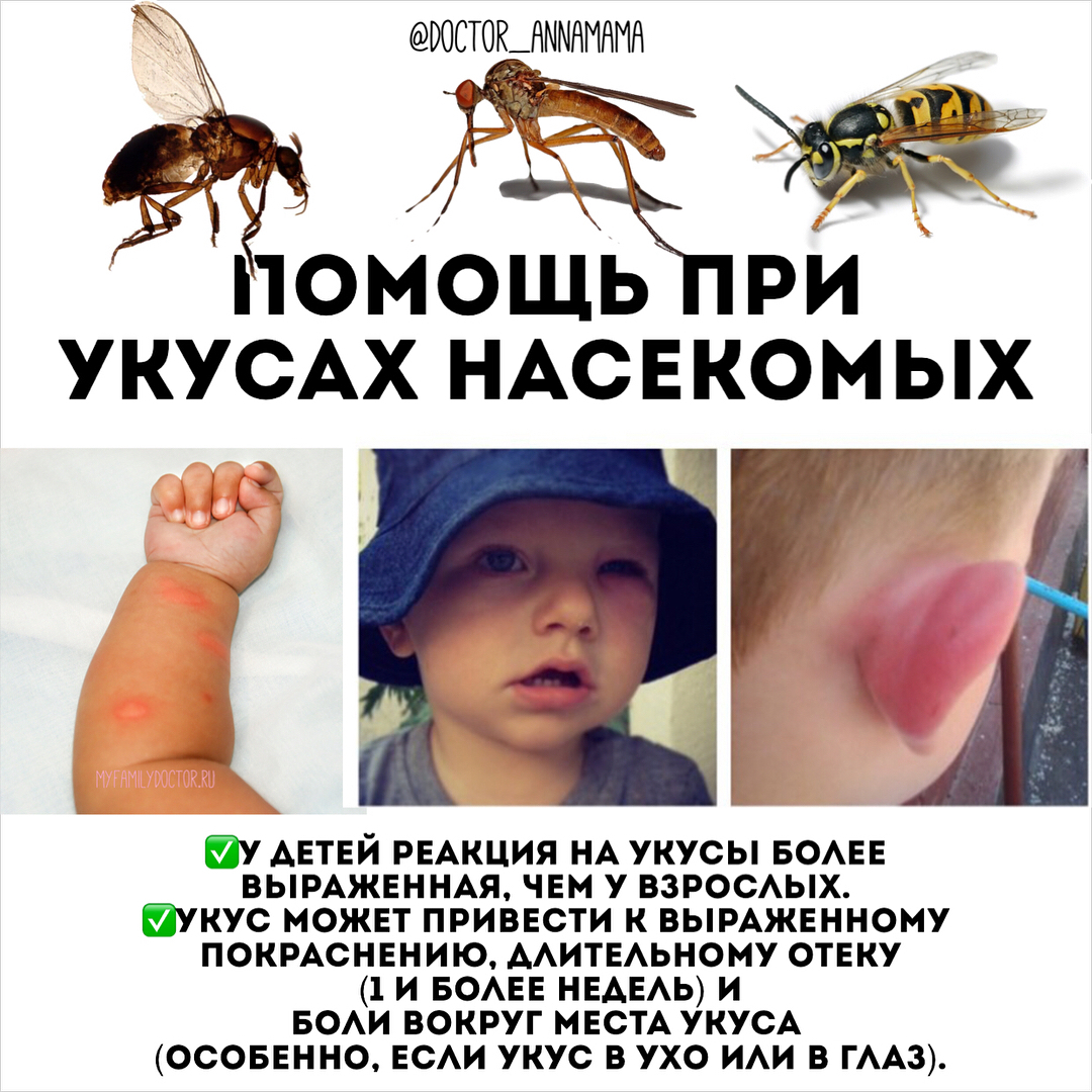 Аллергия на укусы насекомых фото Помощь при укусах насекомых