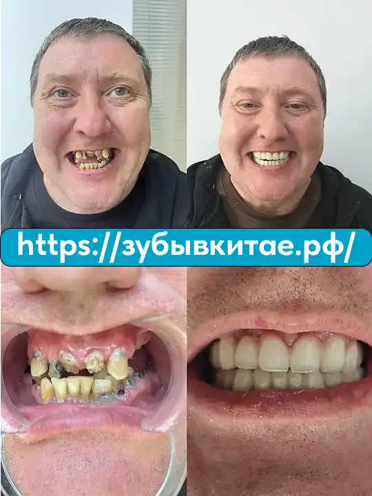 До и после — кейс 14