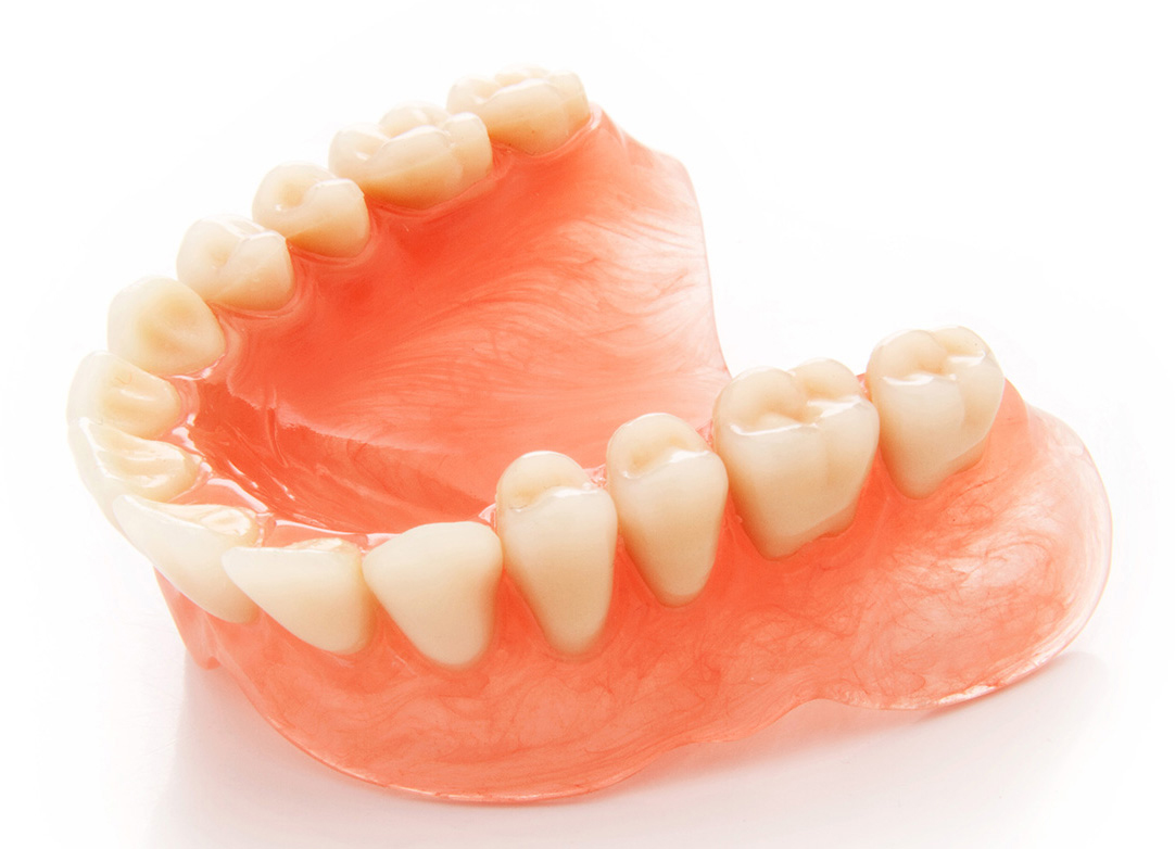 Съемный протез зубов какие бывают. Нейлоновый микропротез 1-3 зуба. Дефлекс нейлоновый протез. Нейлоновые полносъемные протезы.