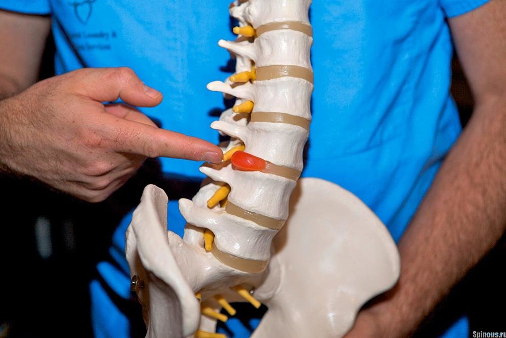 Лечение суставов и позвоночника 3.jpg