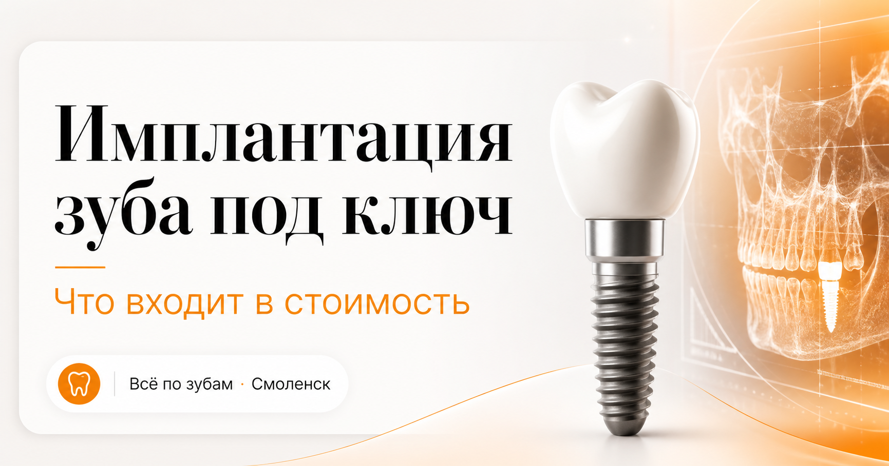 Имплантация зуба под ключ в Смоленске — что входит в стоимость
