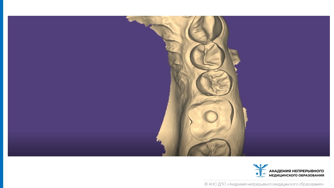 Моделирование в стоматологии