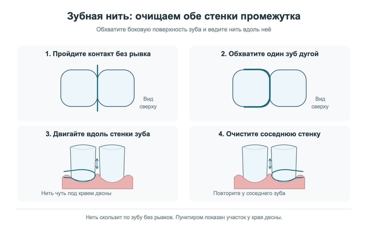 Пошаговое применение зубной нити