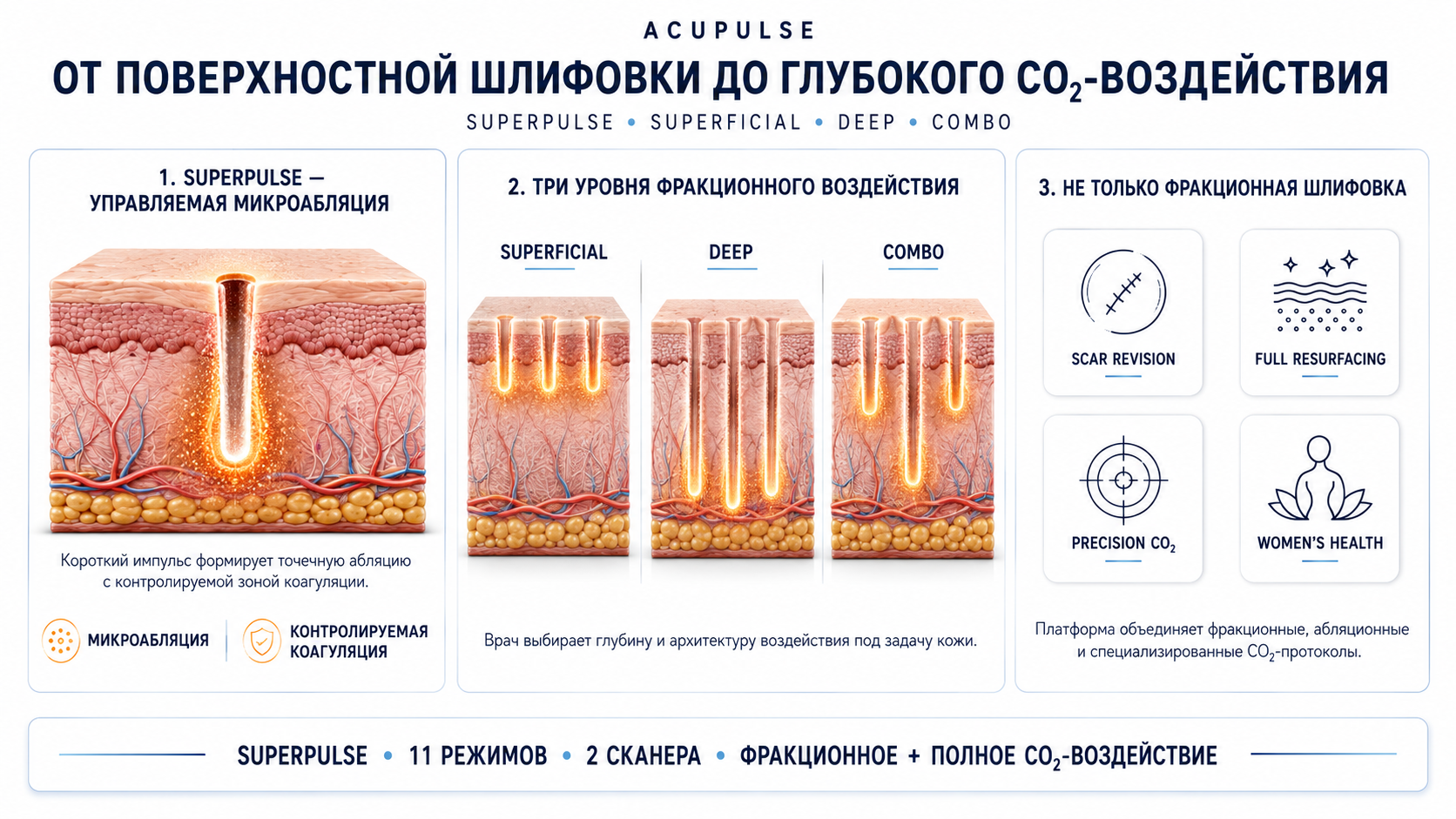 AcuPulse: схема воздействия CO2 10 600 нм
