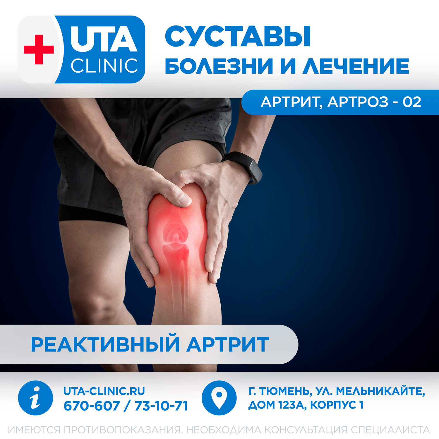 Реактивный артрит — причины, диагностика и лечение в Астрахани | Болезни | Клиника «Консилиум»