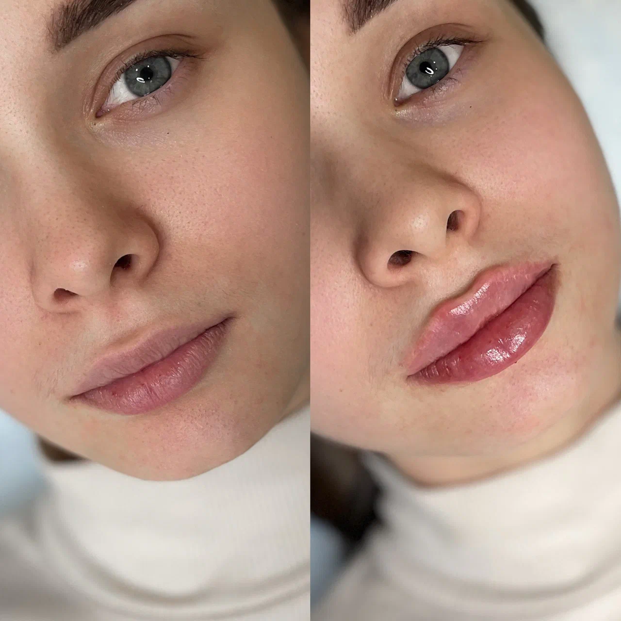 Материал из портфолио Inlove Beauty