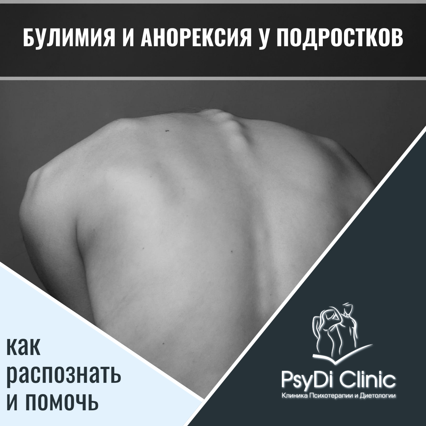 Булимия и анорексия у подростков: как распознать и помочь