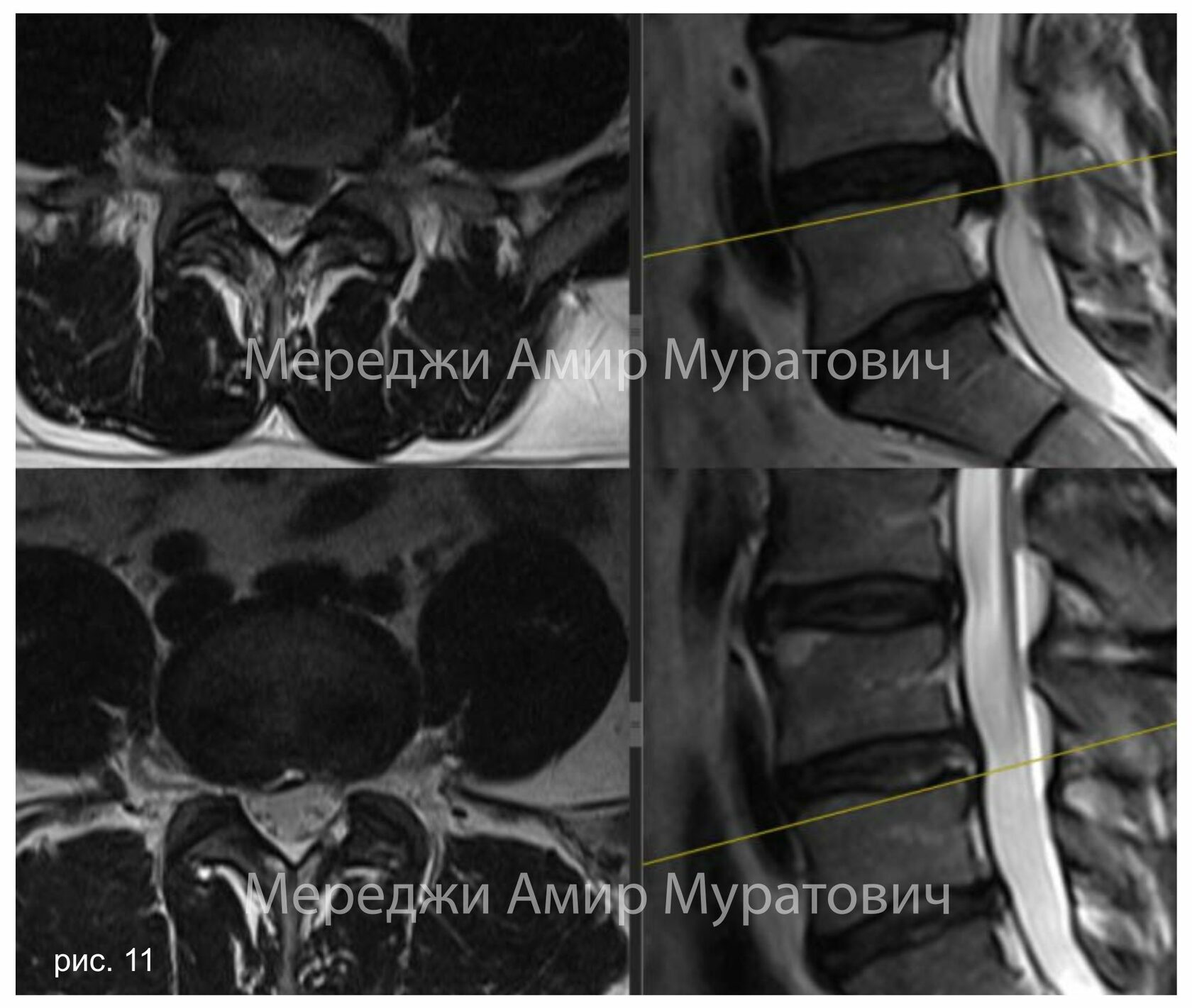 Амир мереджи нейрохирург