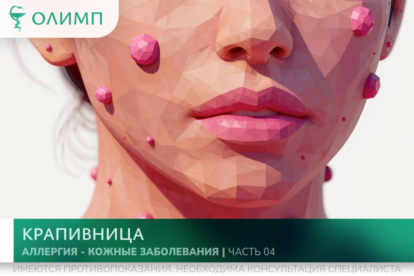 олимп тюмень медицинский центр клиника терапевт медцентр в тюмени олимпийская мельникайте аллергия