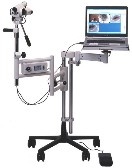 Кольпоскоп Leisegang с видеосистемой 3MV для гинекологических исследований
