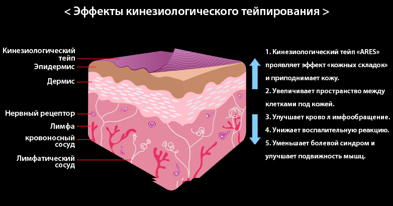 Схемы тейпирования для похудения живота и боков