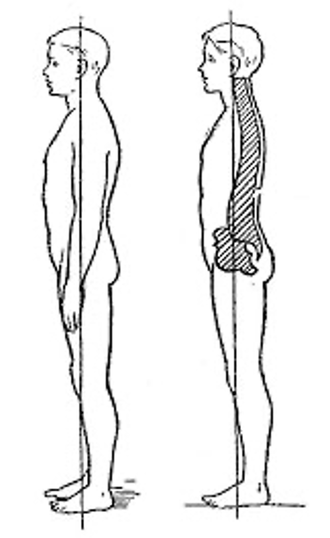 Затылком лопатками ягодицами пятками. Правильная осанка. Правильная осанка у человека. Правильная осанка вид сбоку. Вертикальное положение тела.