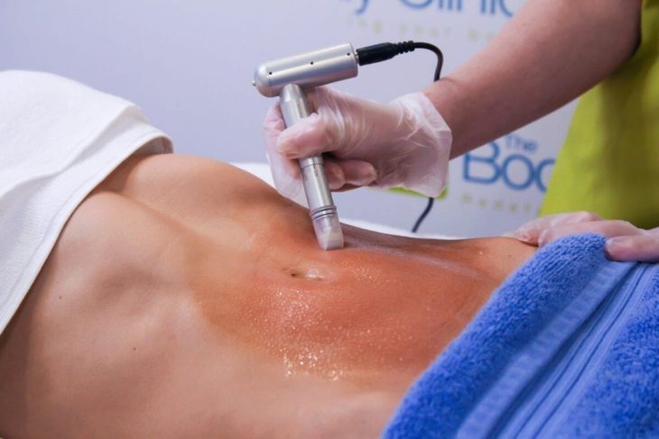 Микронидлинг