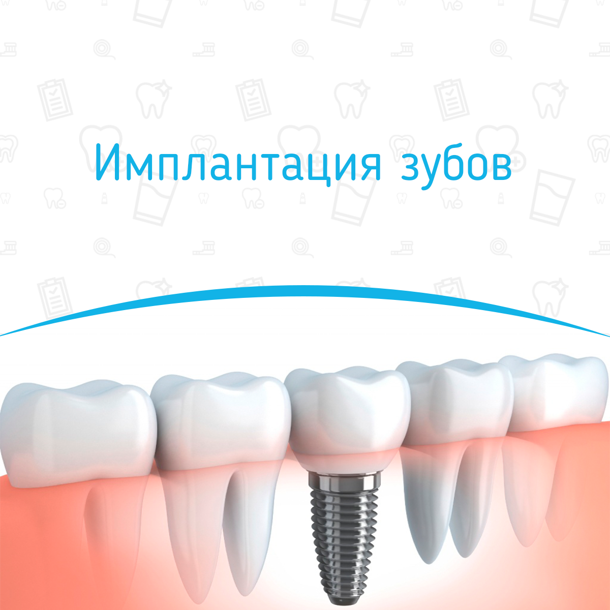 Имплант под ключ. Имплантация зубов реклама. Акция на имплантацию зубов. Реклама зубных имплантов.