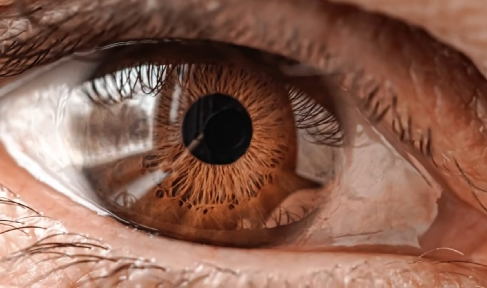 Признаки глаукомы, ее причины и методы лечения – как выявить и вылечить глаукому